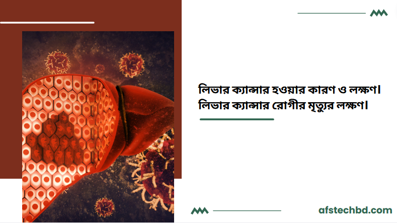 লিভার ক্যান্সার হওয়ার কারণ ও লক্ষণ। লিভার ক্যান্সার রোগীর মৃত্যুর লক্ষণ